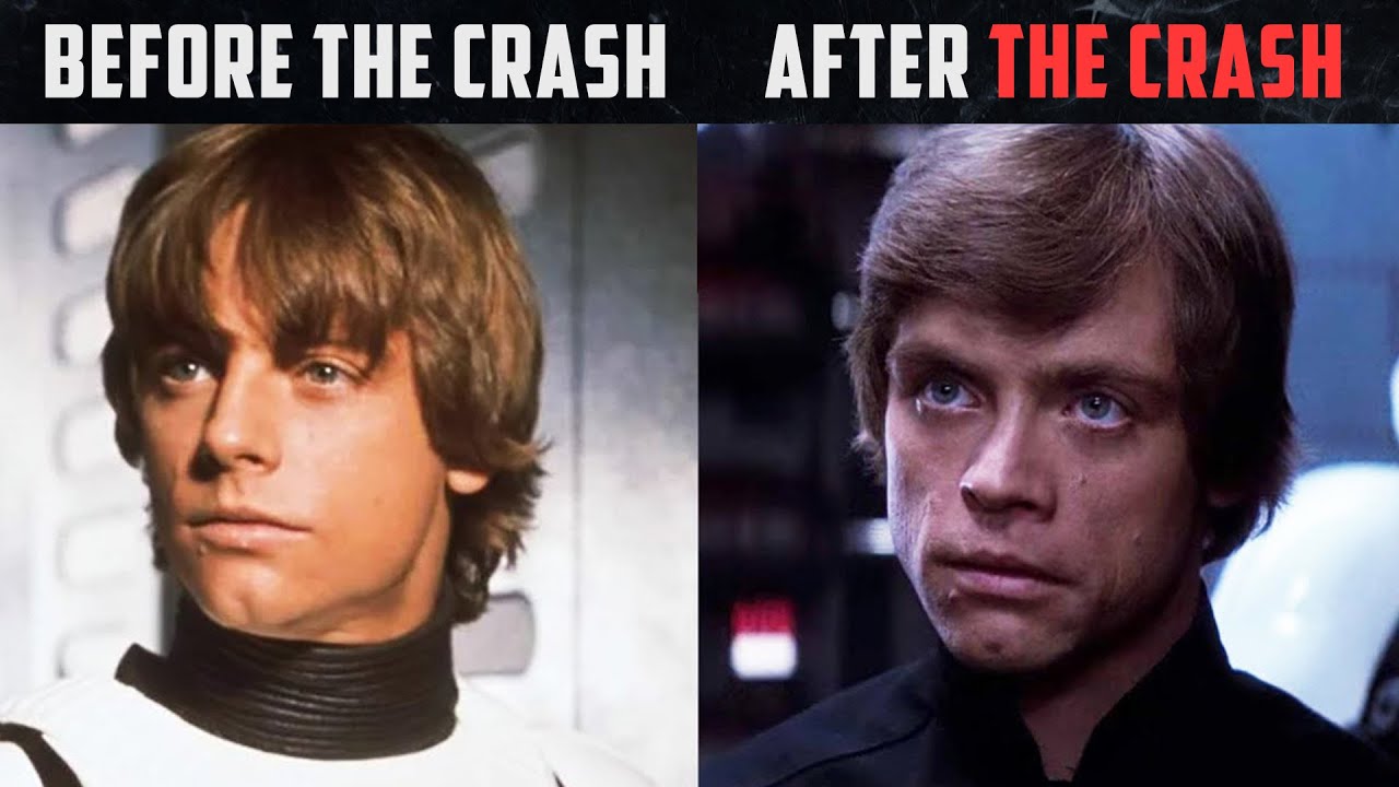 This is why Luke's face changed after «A NEW HOPE» (Terrible crash)