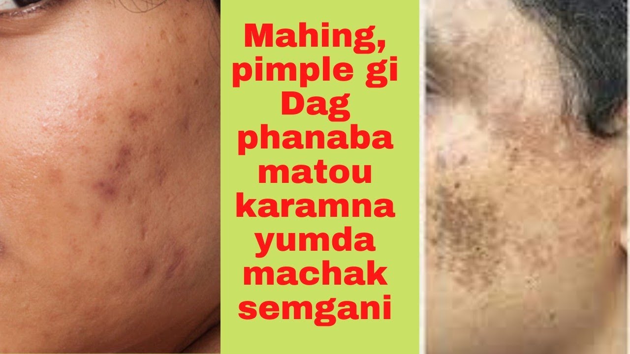 mahing fanaba,uring gi dag koknaba matau karamna yumda machak semgani adoga matau karamna taibigani