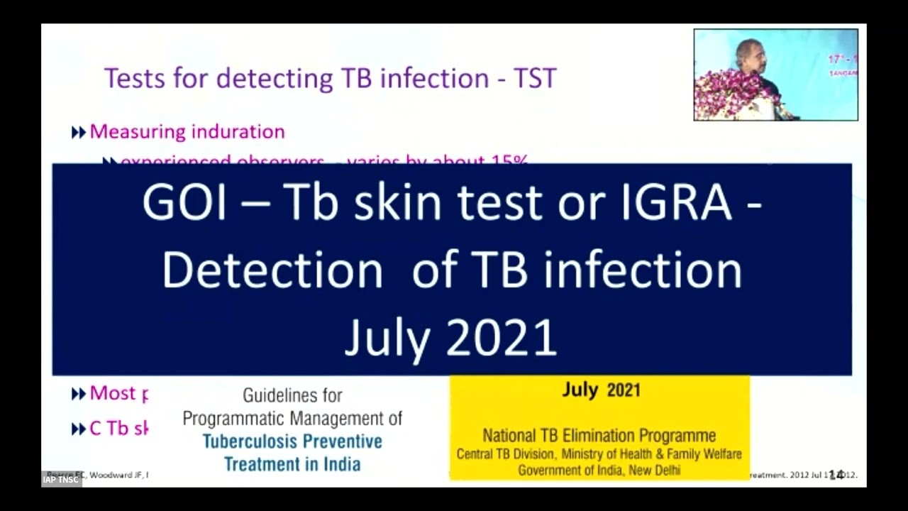 Reality of Childhood Tuberculosis — Over Or Underdiagnoses - Dr. N.C.Gowrisankar
