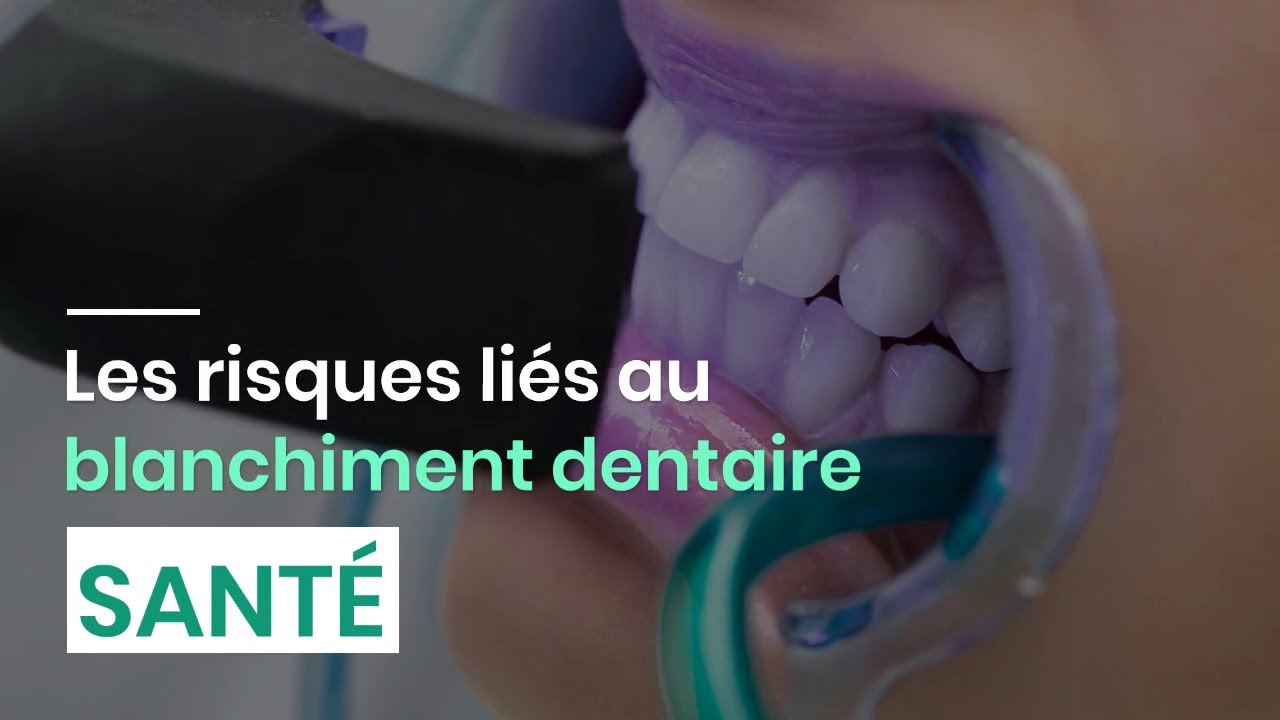 Les risques li&eacute;s au blanchiment dentaire