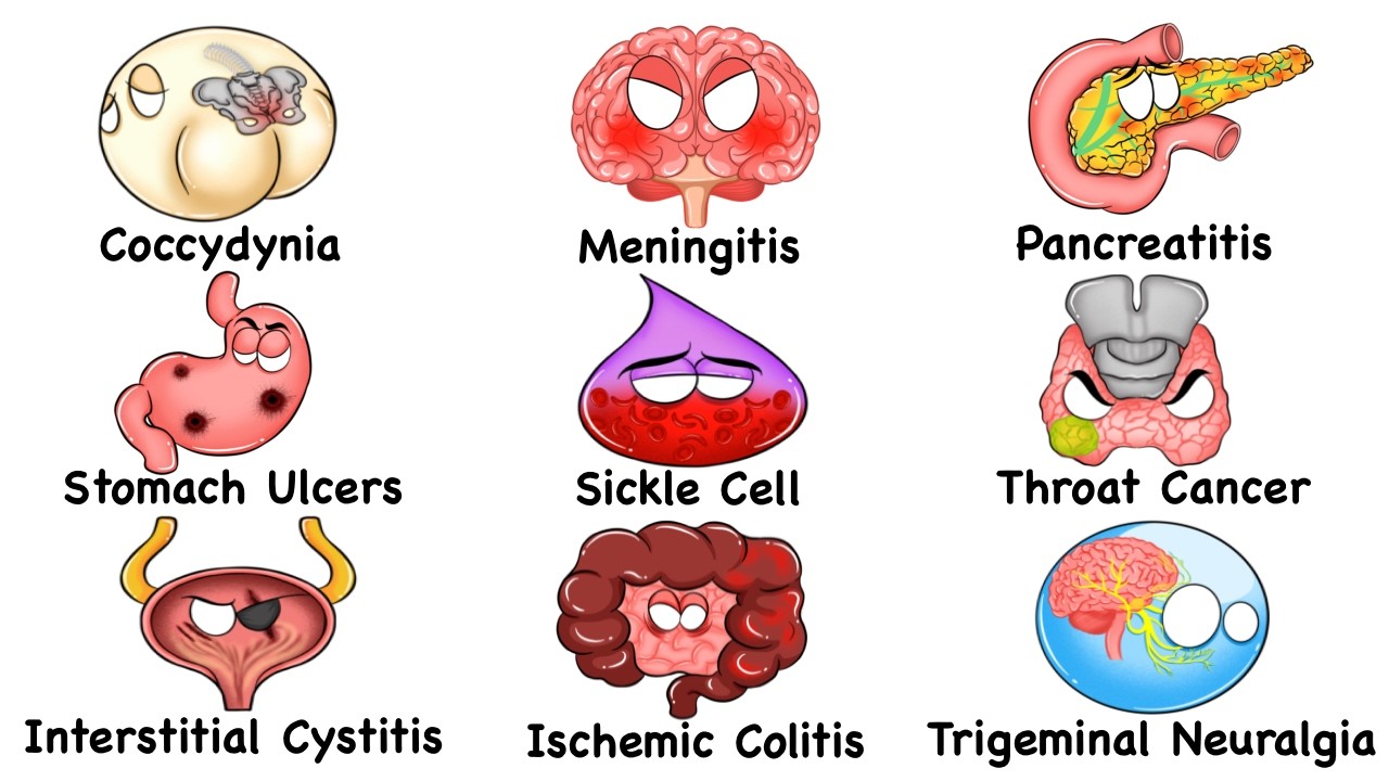 Every PAINFUL Disease Explained in 16 Minutes