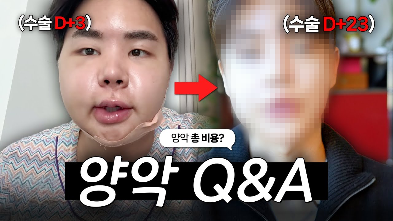 양악수술, 가격부터 통증 붓기관리, 궁금한거 다 알려드림 (댓글 이벤트 있어요🍀)