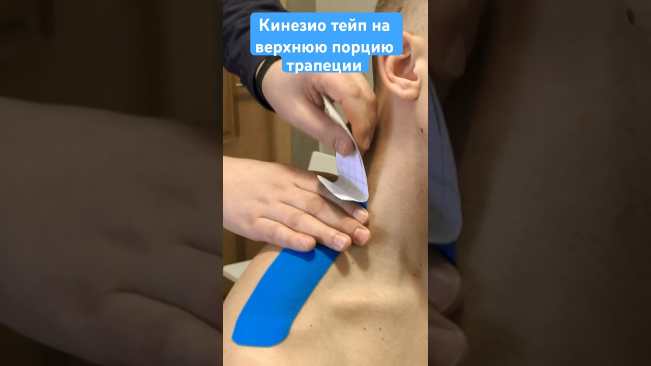 Кинезио тейп при болях в шее