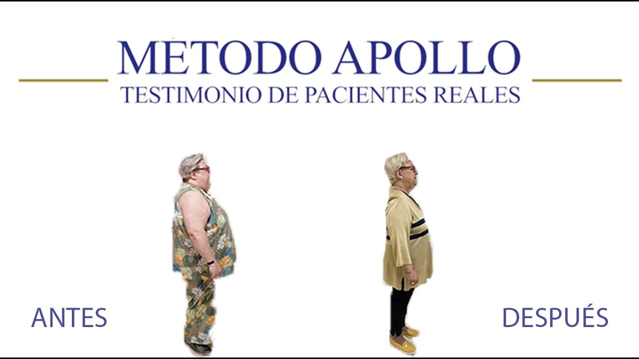 ✅ Casos Reales | Reducción de estómago con método APOLLO