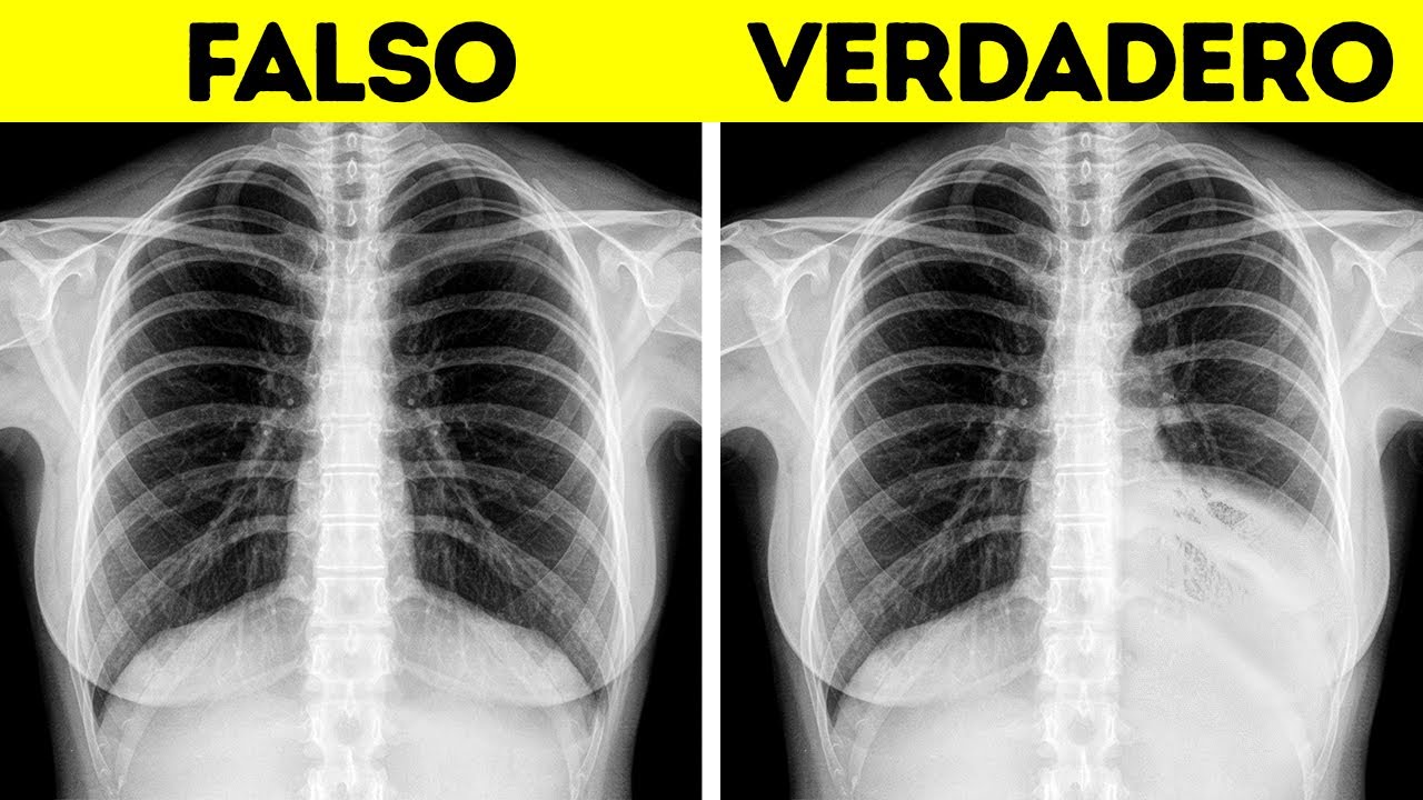 25 Datos cortos sobre el cuerpo para asombrar y deslumbrar a la gente