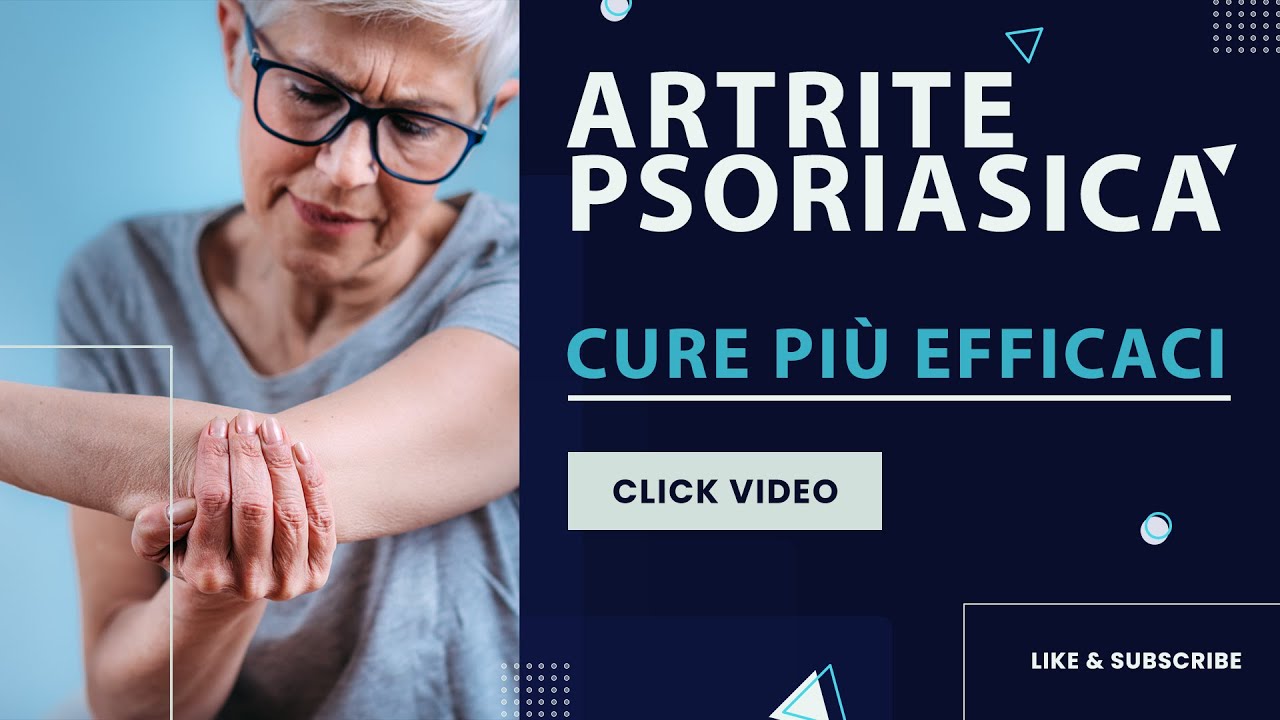 L’artrite psoriasica, cure più efficaci se tempestive