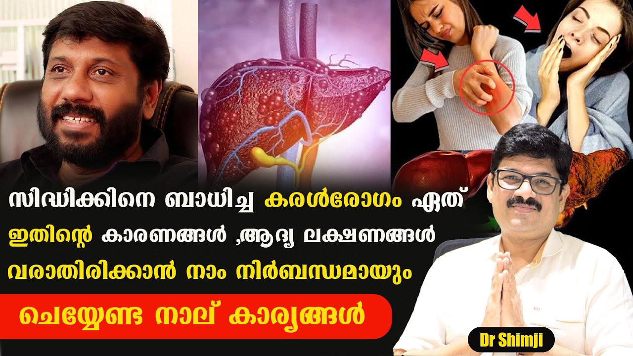 #സിദ്ധിക്കിനെ ബാധിച്ച #കരൾരോഗം ഏത്  ,ആദ്യ ലക്ഷണങ്ങൾ .ഇത് വരാതിരിക്കാൻ നാം ചെയ്യേണ്ട നാല് കാര്യങ്ങൾ