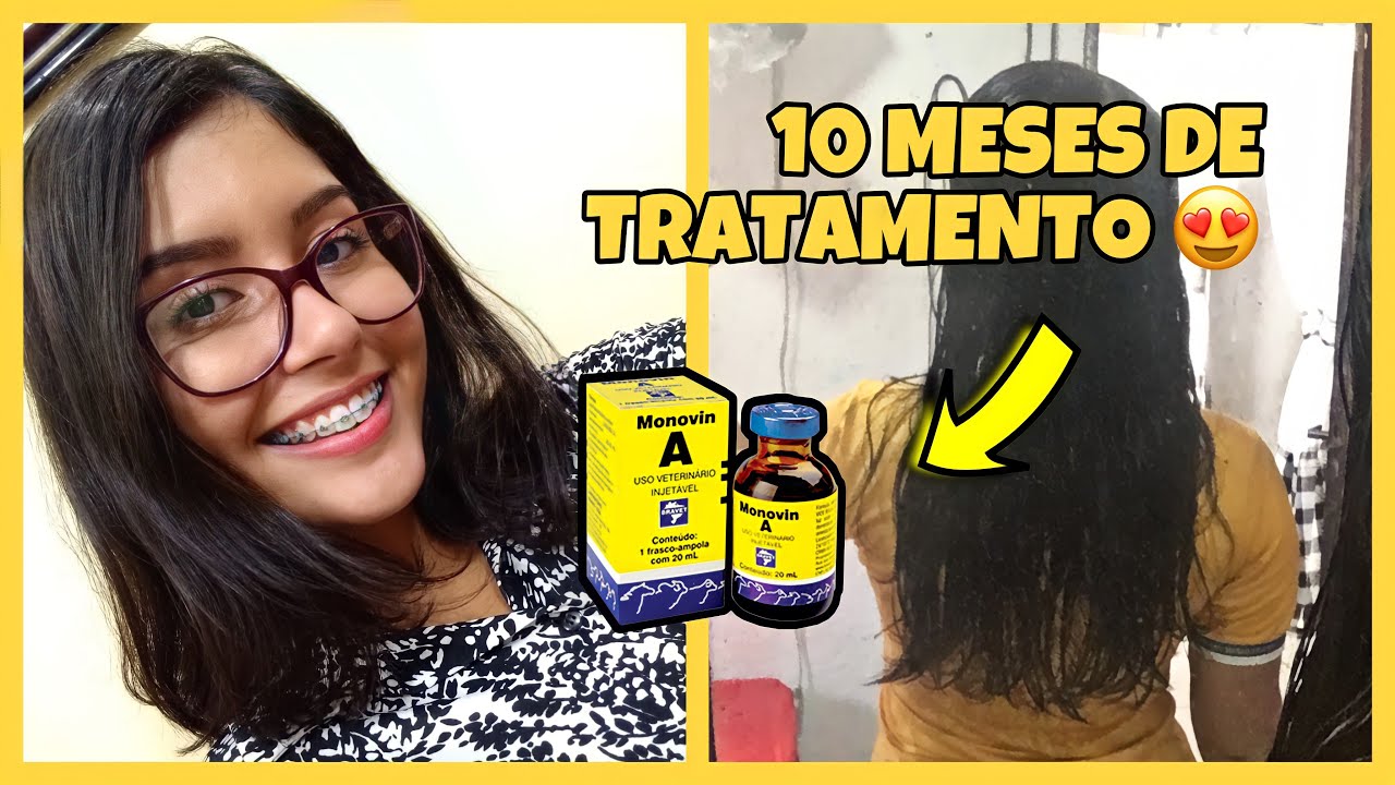O INCRÍVEL CRESCIMENTO DO MEU CABELO COM O MONOVIN A | Minha Experiência