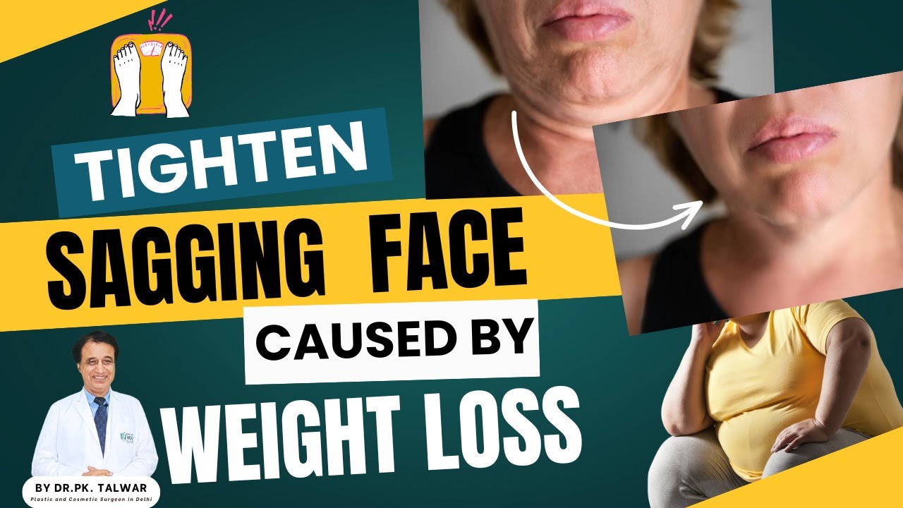 Full Face Lift Surgery for Sagging Skin | Best Anti-Aging Treatment by Dr. P.K. Talwar in Delhi