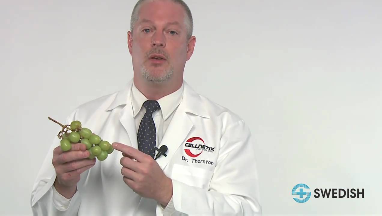 Understanding Pathology for Breast Cancer