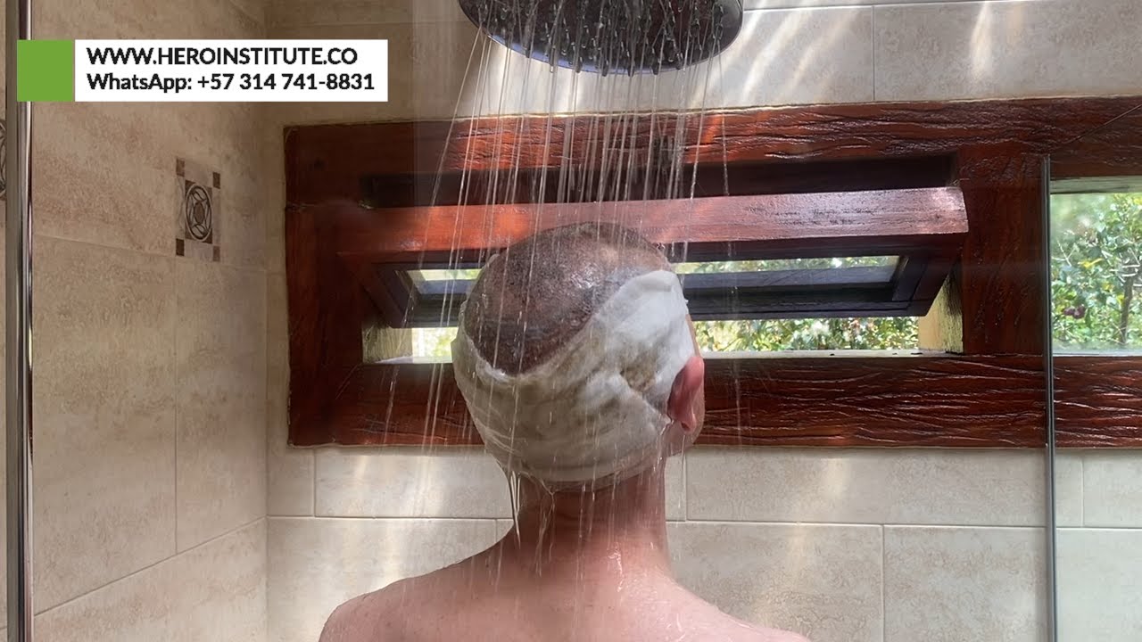 ¡Primer lavado implante capilar en CASA!