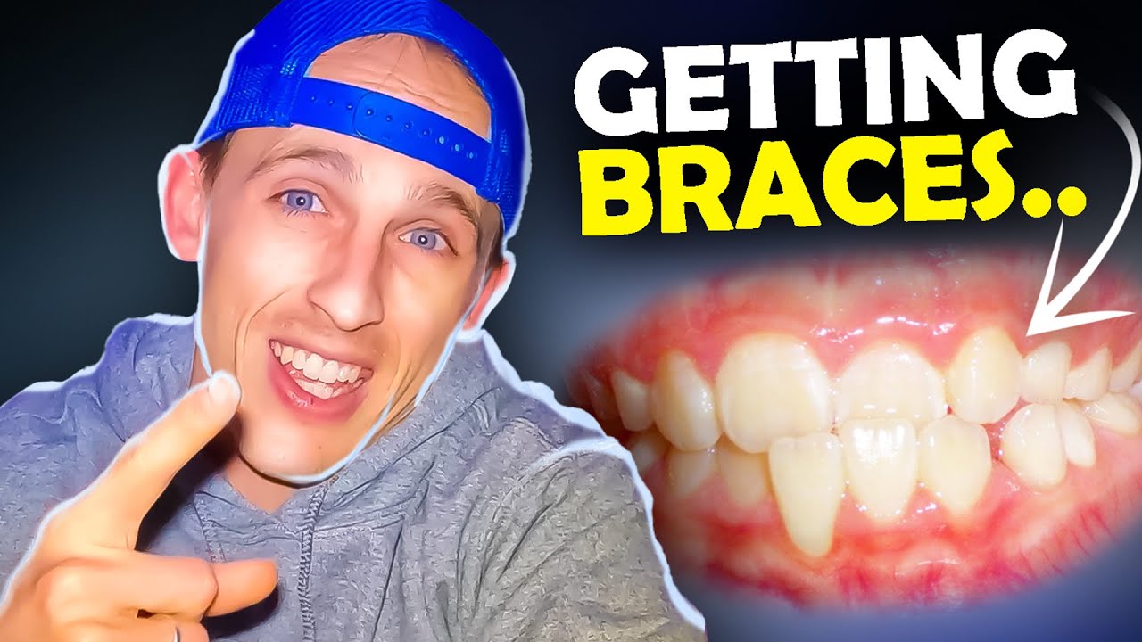 Getting Braces? Questions you SHOULD be asking your ORTHODONTIST AND DENTIST...