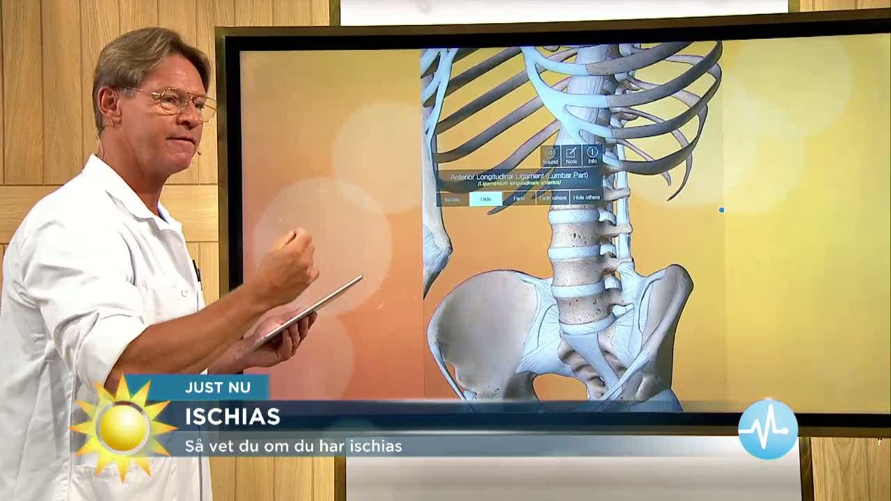 Dr Mikael - Så vet du om du har ischias - Nyhetsmorgon (TV4)