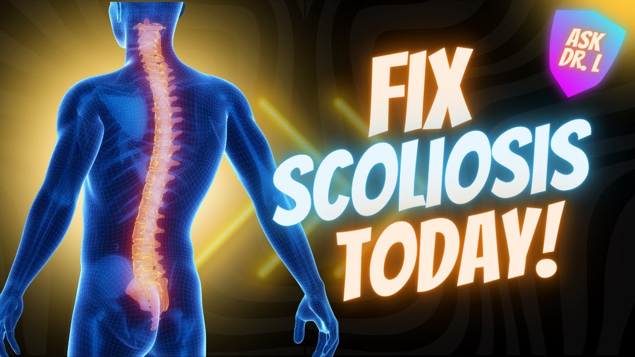 Learn How To Fix Scoliosis At Home | how to treat scoliosis  | The Ultimate Guide