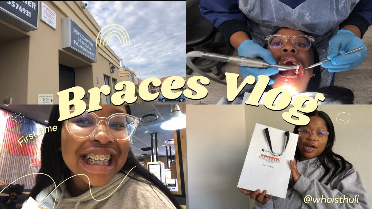 Come get braces with me for the first time | Braces Vlog 2023 | SA YouTuber