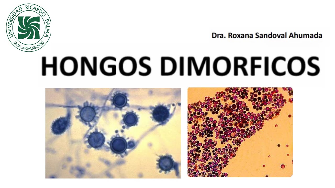 Microbiología - Hongos dimórficos - Unidad3 - sem15 URP