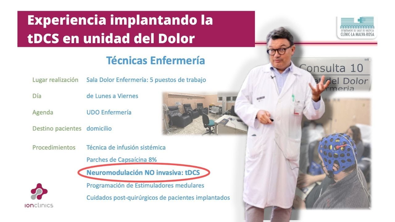 Experiencia implantando la tDCS en unidad del Dolor por el Dr. Carlos Tornero
