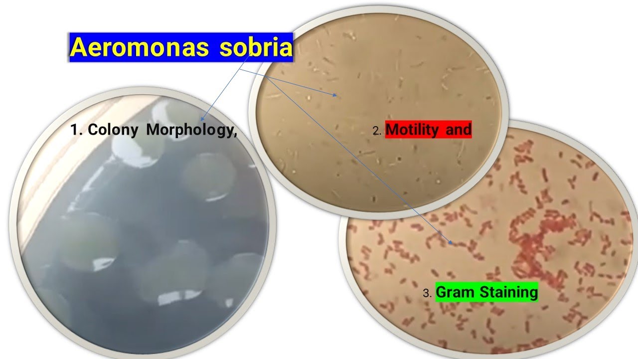 Aeromonas sobria Colony Morphology, Motility and Gram Staining