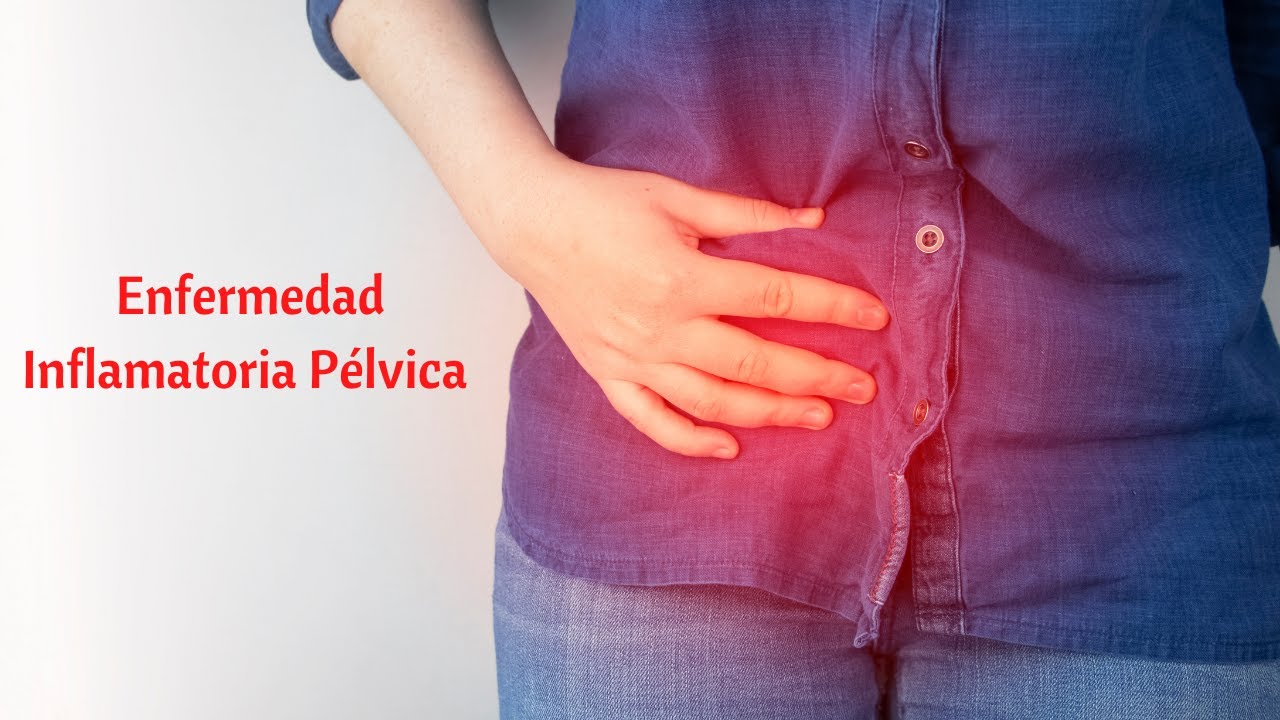 Enfermedad inflamatoria pélvica (1era Parte)