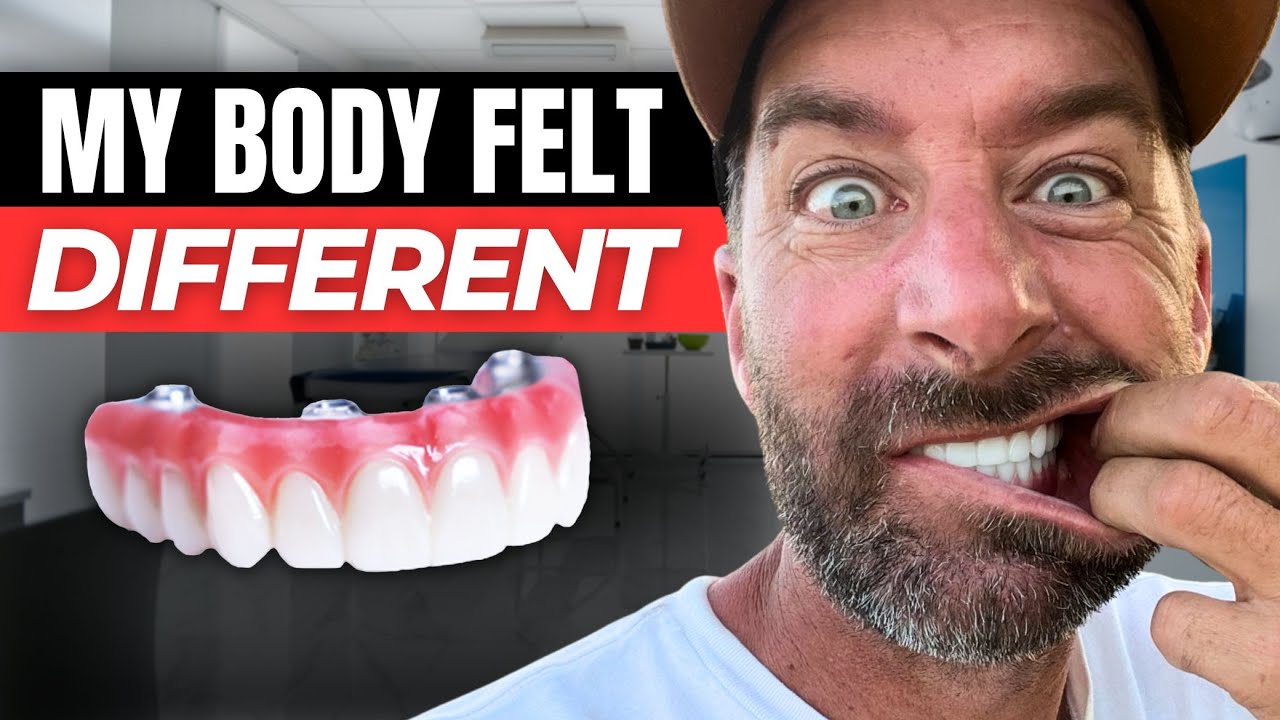 The Side Effects of My Dental Implants No One Talks About