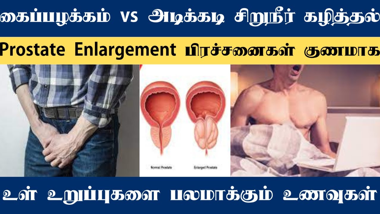 கைப்பழக்கம் VS அடிக்கடி சிறுநீர் கழித்தல் |Prostate Enlargement பிரச்சனைகள் | உள் உறுப்புகளை பலமாக்க
