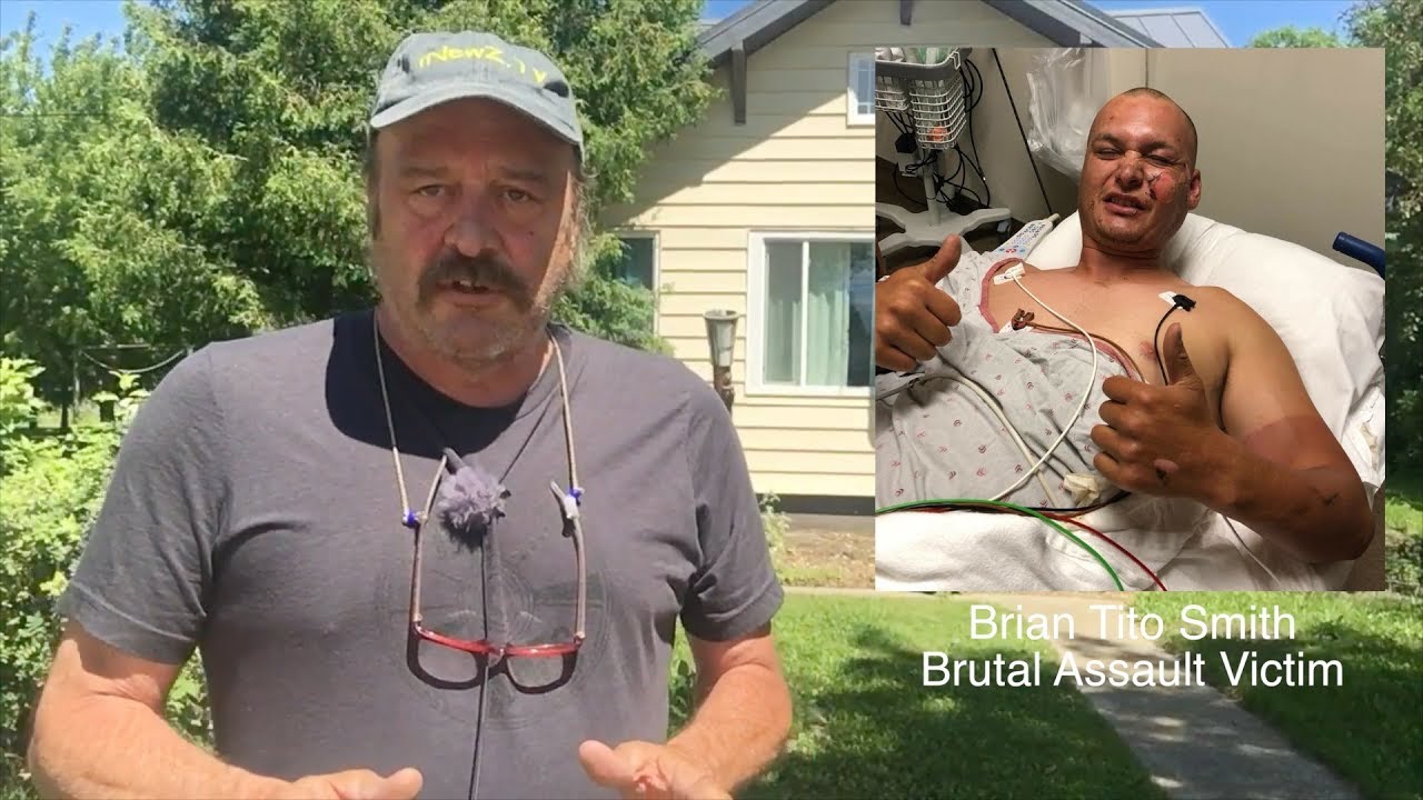 BREAKING NEWS: Brutal, Vicious Attack In Mahnomen, MN