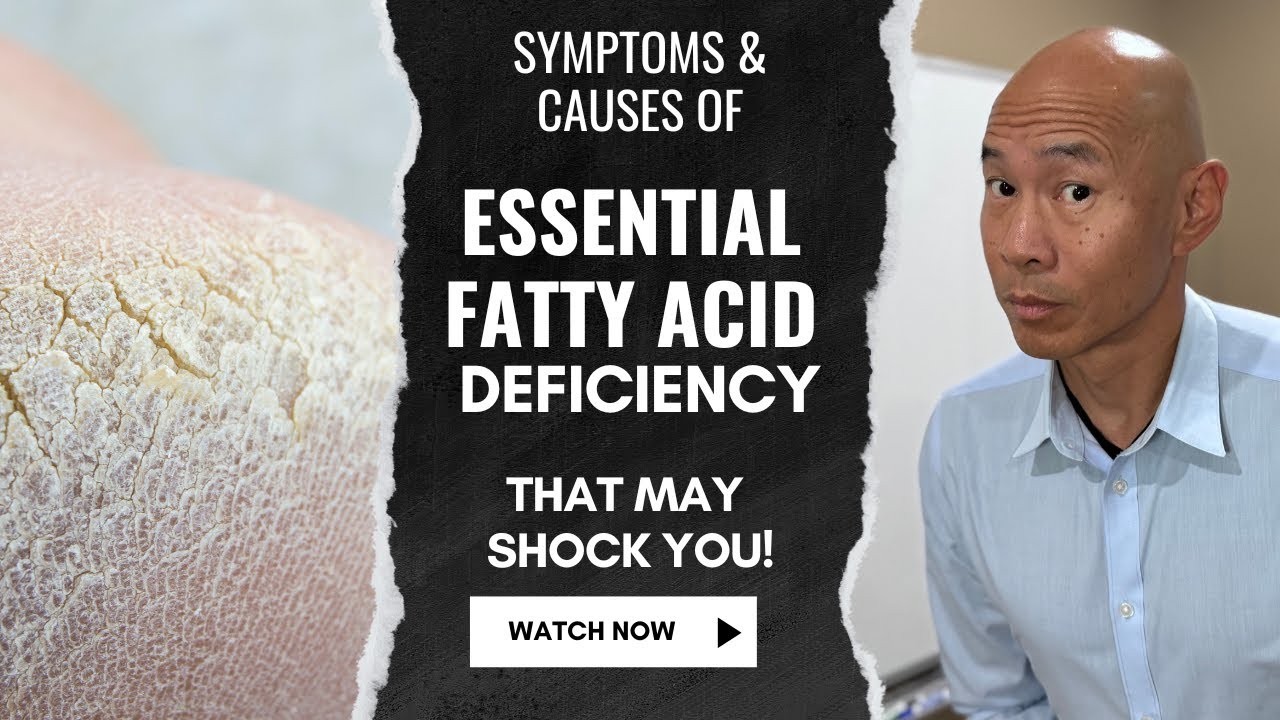 Symptoms and Causes of Essential Fatty Acid Deficiency That May Shock You! Dr. Peter Kan