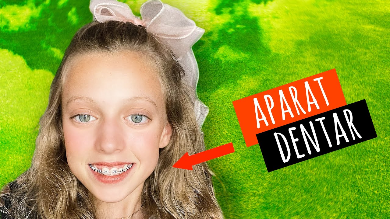 😬 Cum Și-a Pus APARAT DENTAR