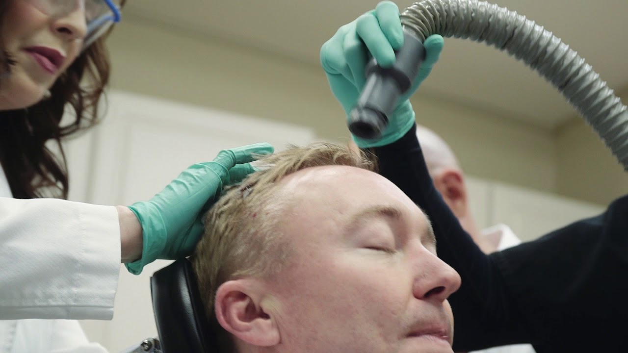 PRP Hair Restoration non-Surgical Solution Bellevue WA Amara Med Spa