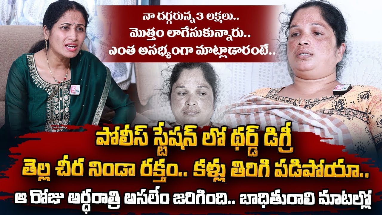 LB Nagar Police Station Third Degree Incident Woman Emotional Interview | SumanTV Information