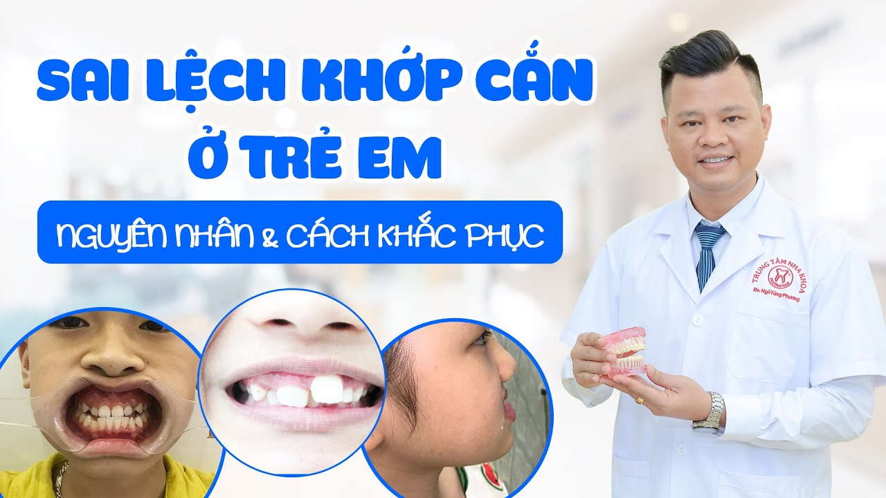 LỆCH KHỚP CẮN Ở TRẺ EM NGUYÊN NHÂN VÀ CÁCH KHÁC PHỤC!| BS NGÔ TÙNG PHƯƠNG