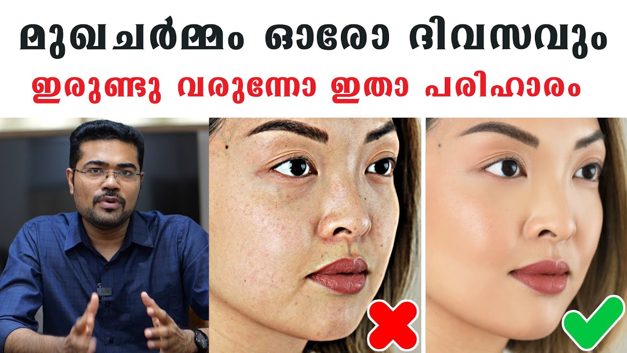 മുഖചർമ്മം ഓരോ ദിവസവും ഇരുണ്ട് ഇരുണ്ടു വരുന്നോ ഇതാ പരിഹാരം /Dr Manoj Johnson / Baiju's Vlogs