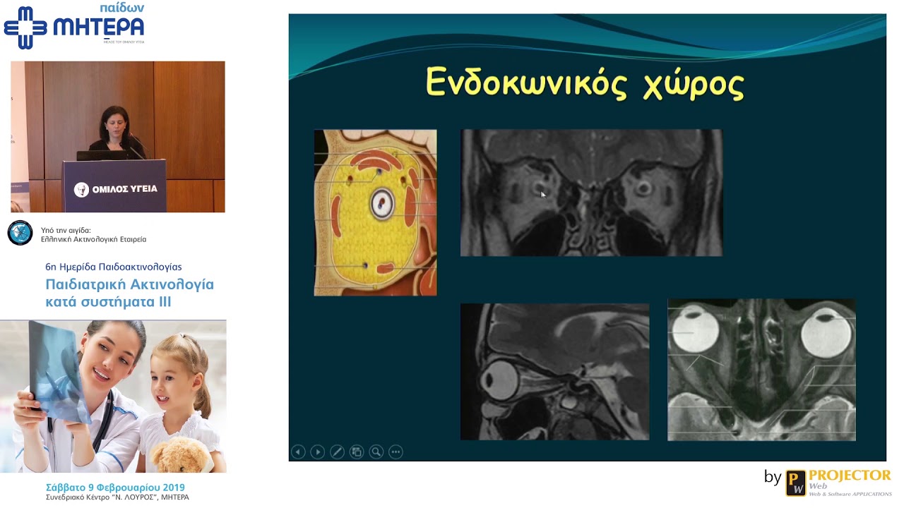 Μαγνητική τομογραφία παιδιατρικών οφθαλμικών κόγχων | Λ. Τζαρούχη