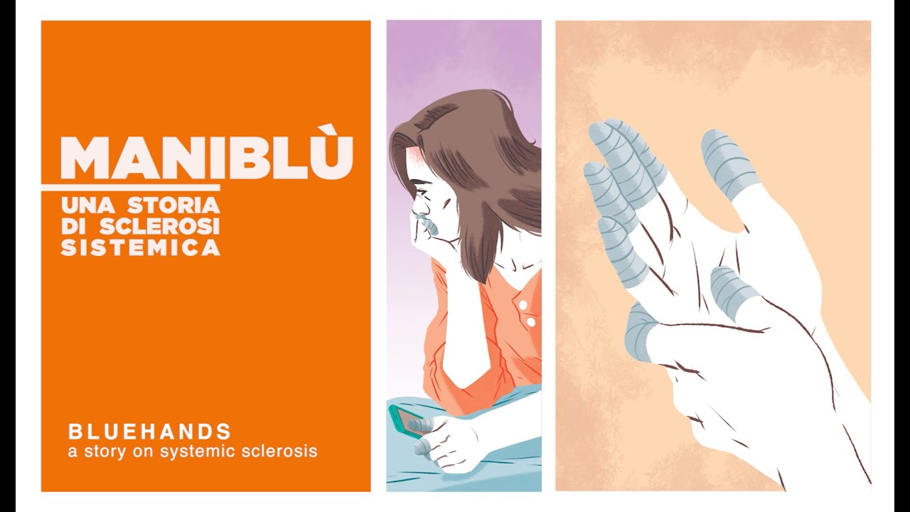 Maniblù: una storia di sclerosi sistemica