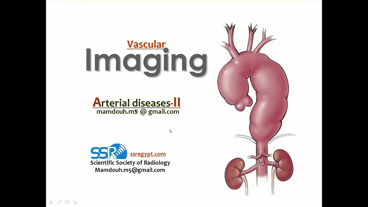 8 Vascular imaging Arteries II TC