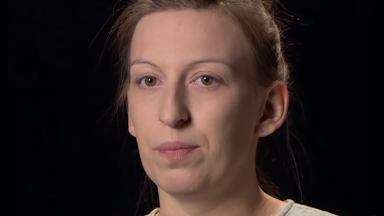 Krzywy nos Angeliki nie pozwalał jej na normalne życie [Powr&oacute;t Doktora Szczyta]