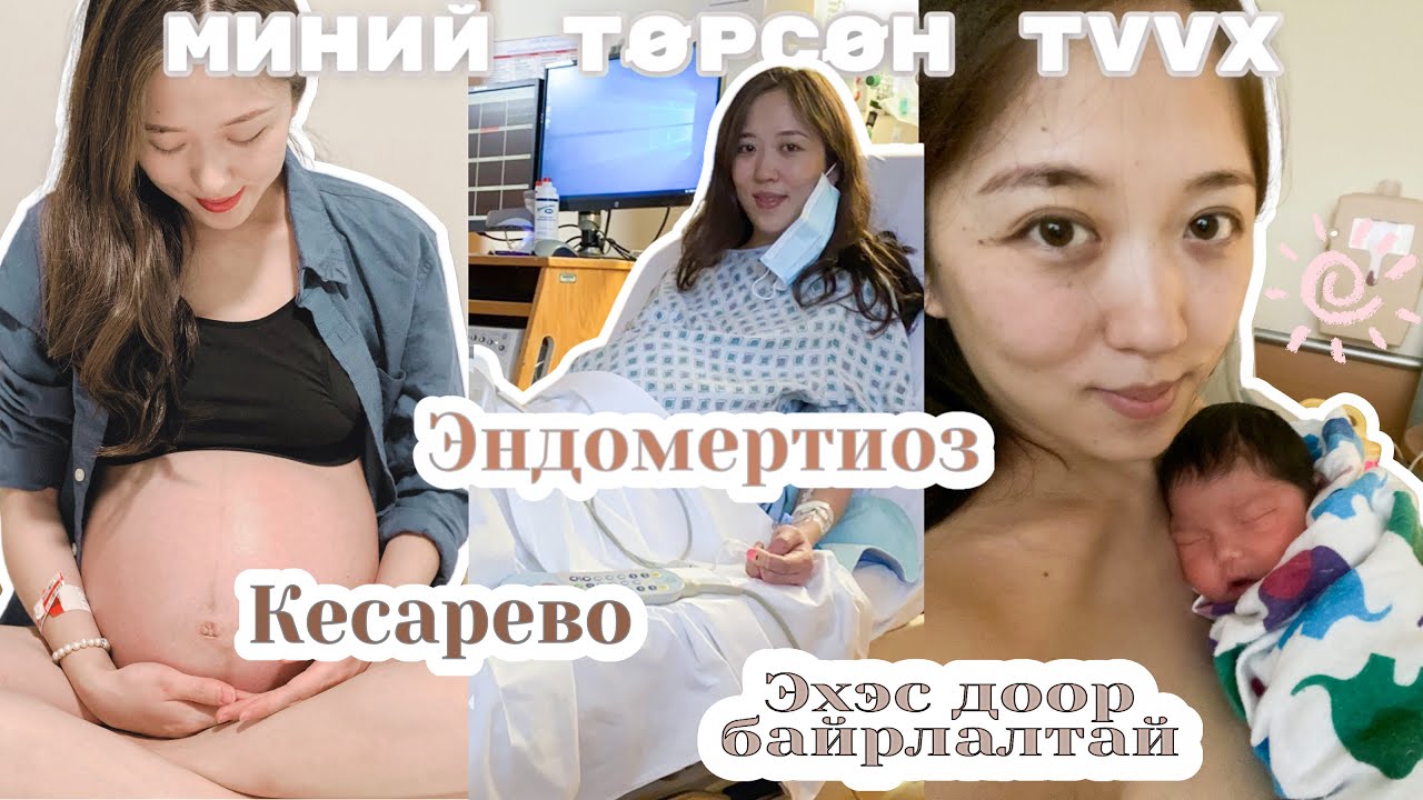 Birth Vlog |Намуун|Эндометроиз|Эхэс доор байрлах|Хийсвэр
