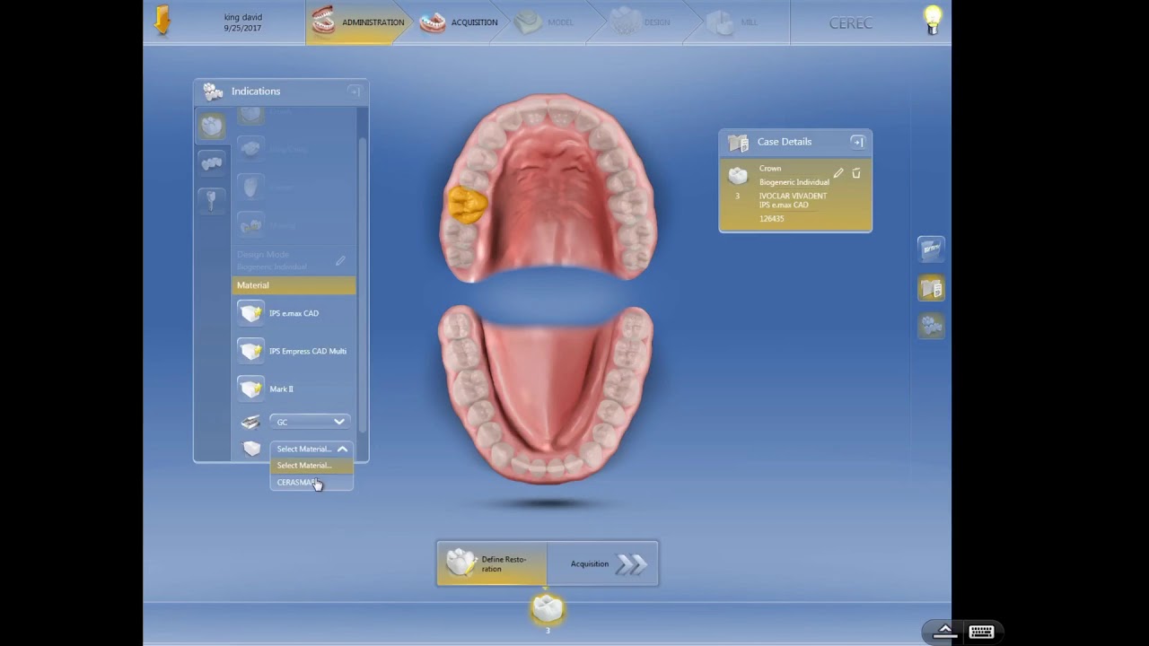 CEREC Dental Assistant Training - Basic Setup for Crown/Bridge