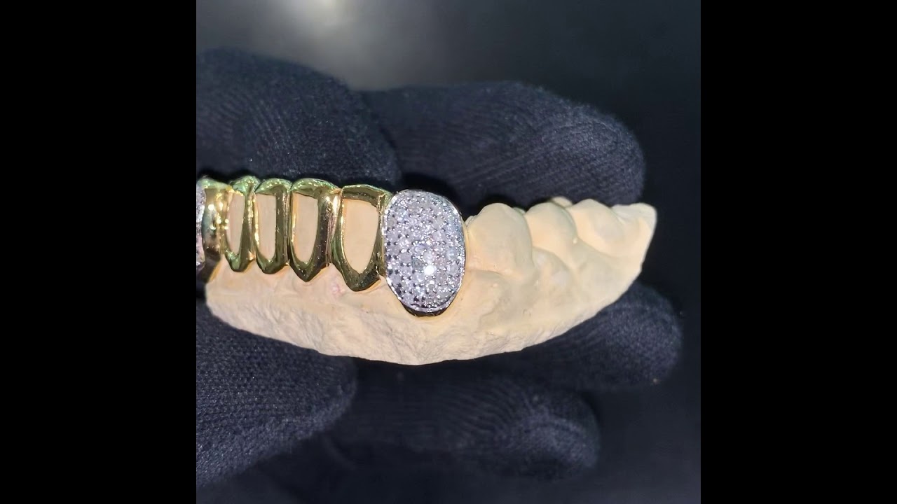 Custom Grillz 6pc Open Face with Handset Real Diamond on Fangs