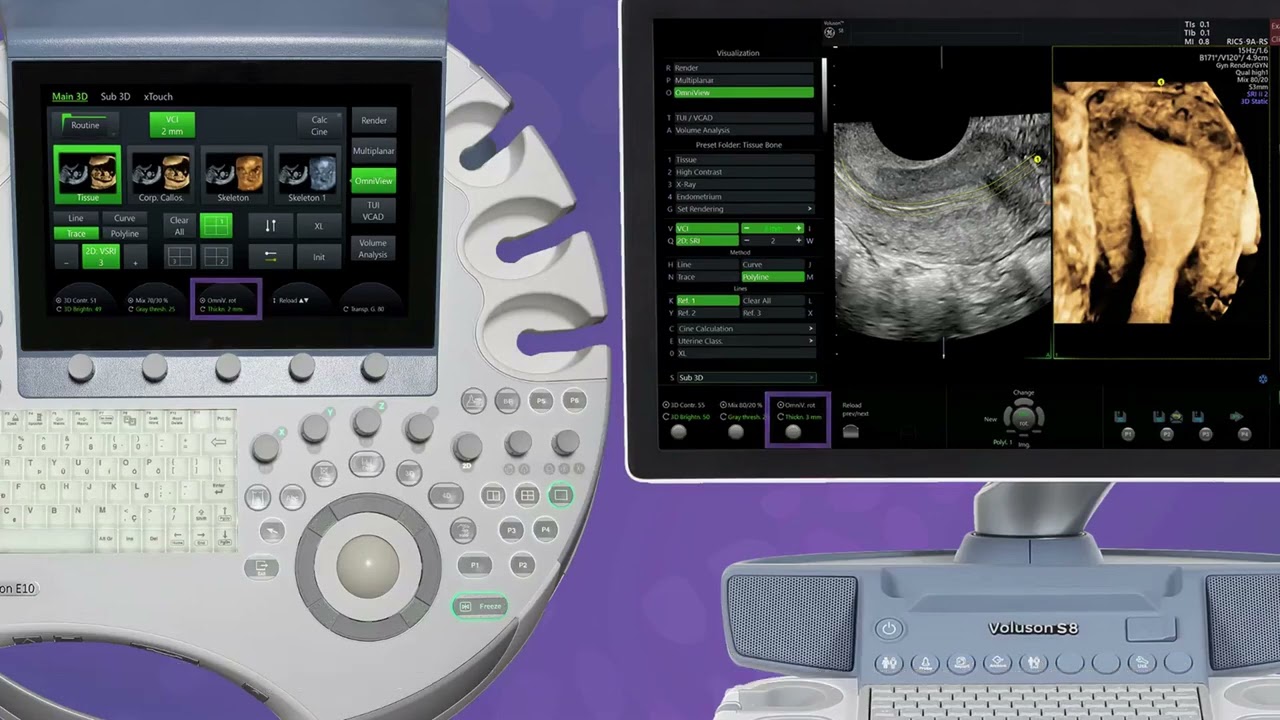 Hướng dẫn thao tác sử dụng Omniview trên máy Voluson của GE Healthcare