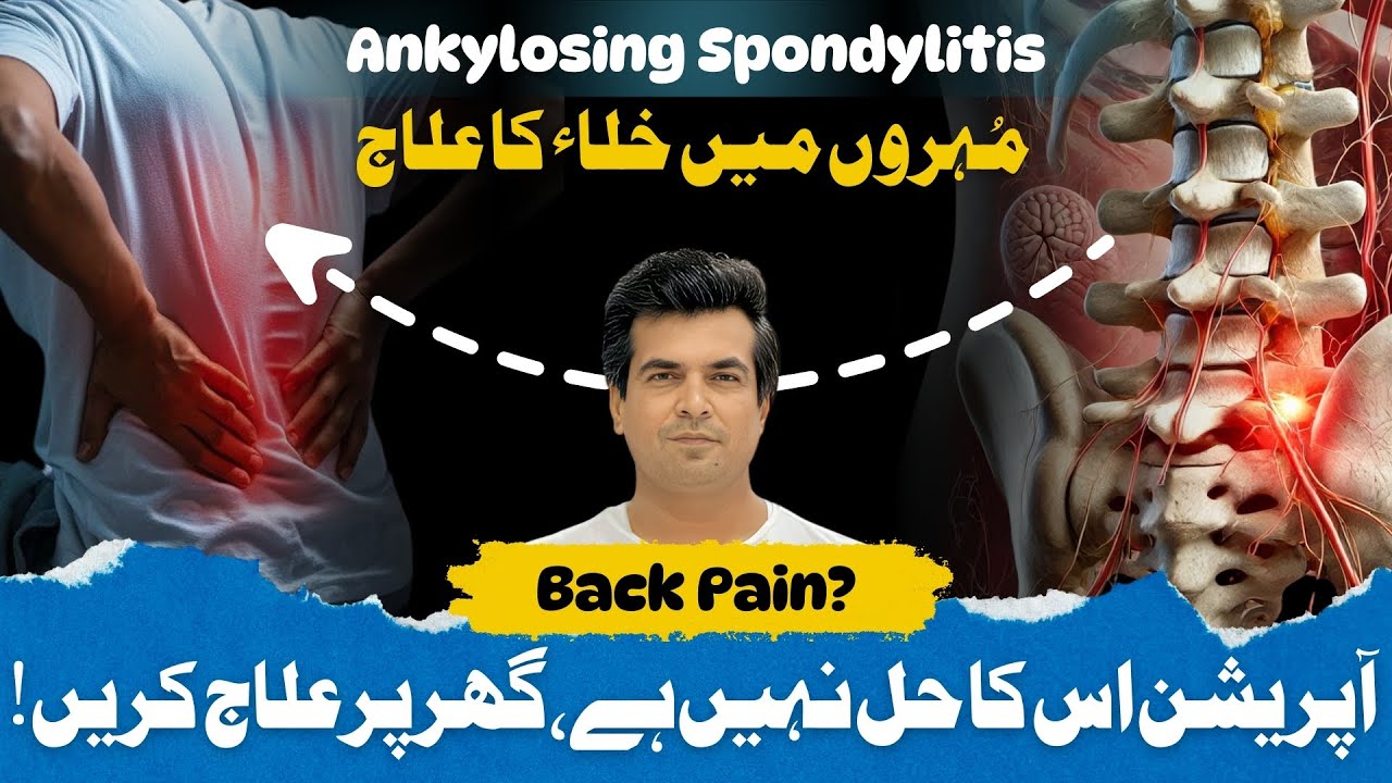 Ankylosing Spondylitis Explained | Causes, Symptoms & Non-Surgical Treatment | ft. Dr. Naseem Abbas