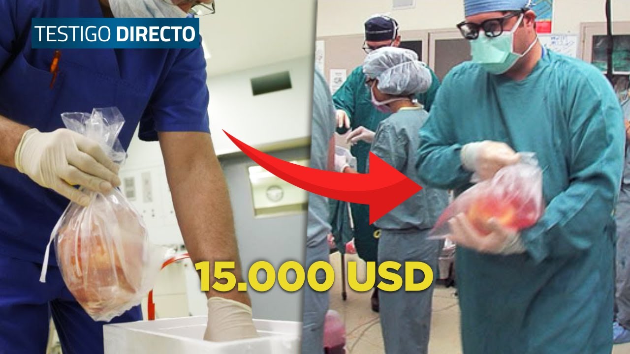 Venta de órganos: esto valen tus ÓRGANOS en el mercado negro - Testigo Directo