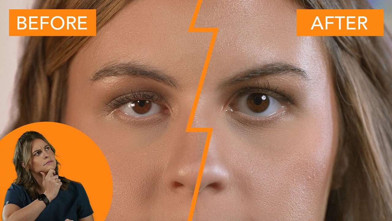 Non-Surgical Eye Lid Lift?