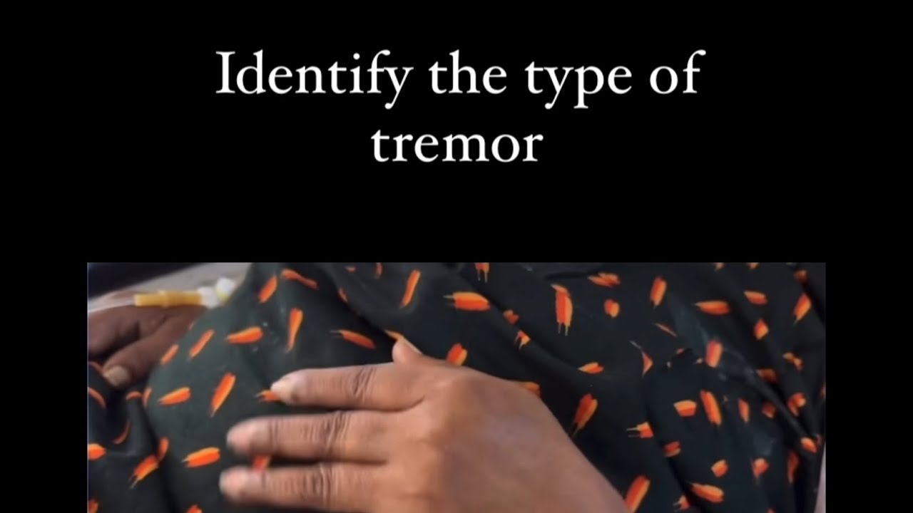 Tremor #clinicalskills #shortsviral #shorts @Drvinitaemergency