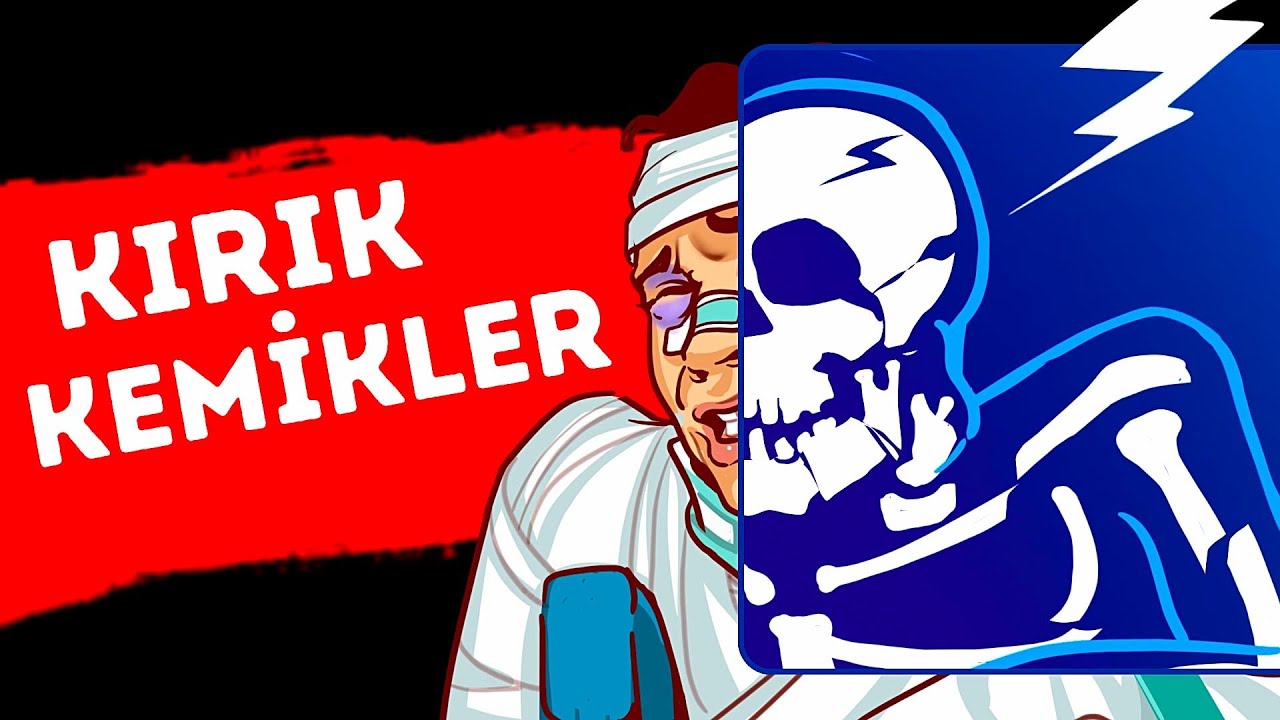 Hem Bacak Hem De Kollarınızı Kırarsanız Ne Olur