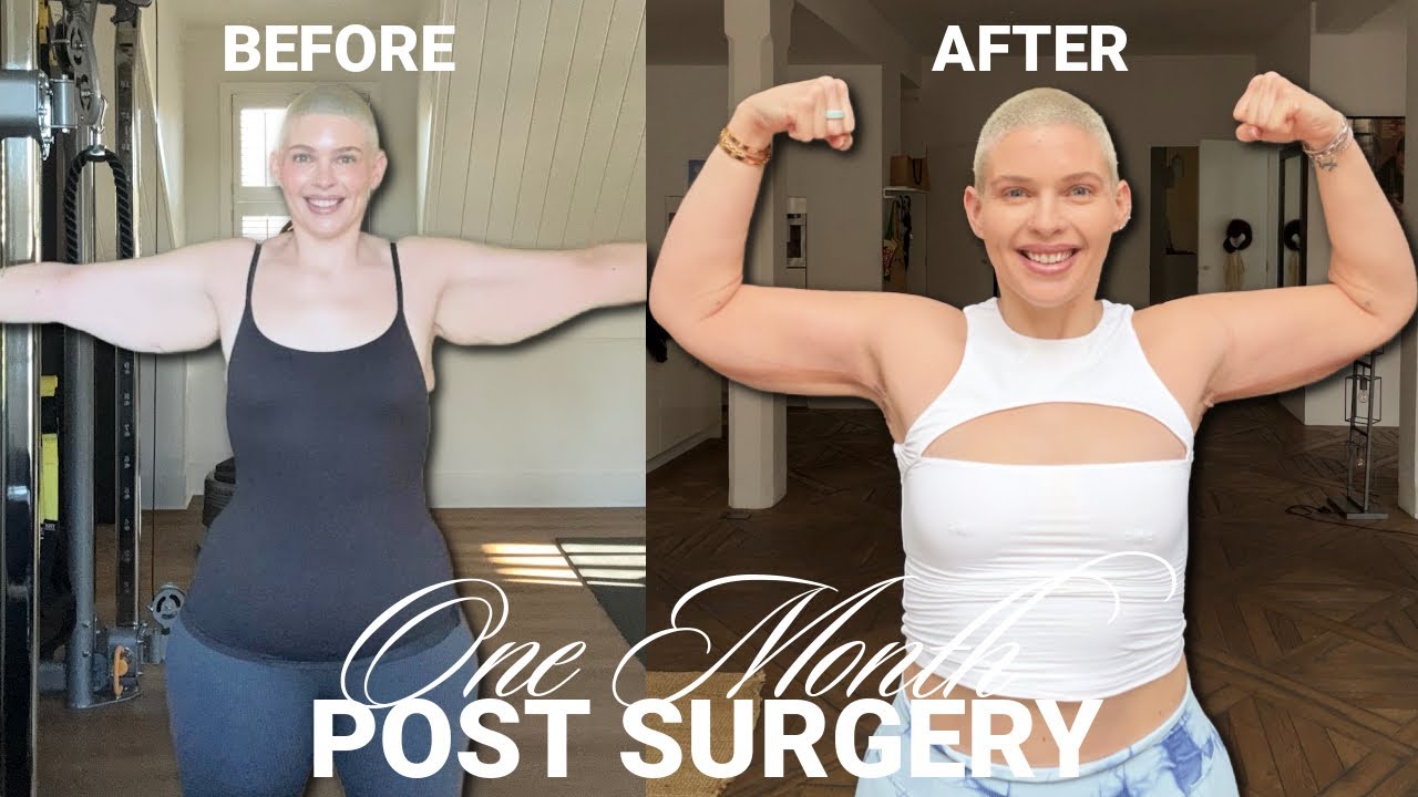 My Recovery *1 Month Post Surgery*