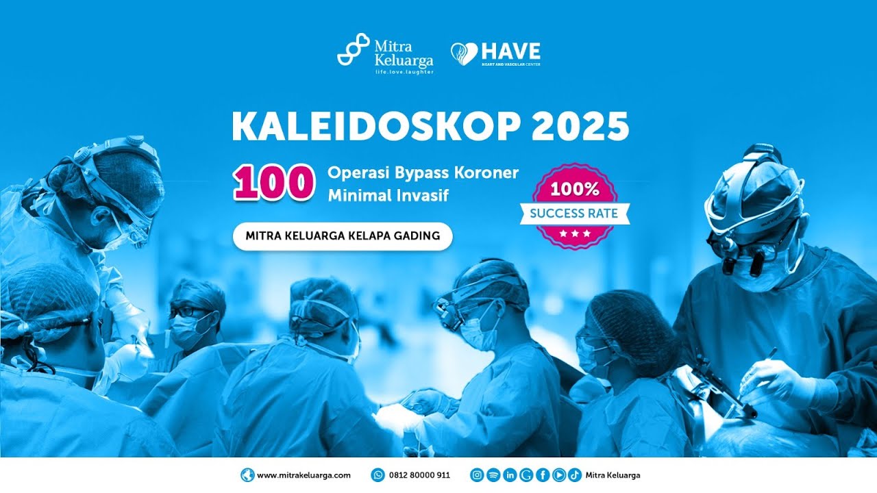 100 Operasi Bypass Koroner Minimal Invasif