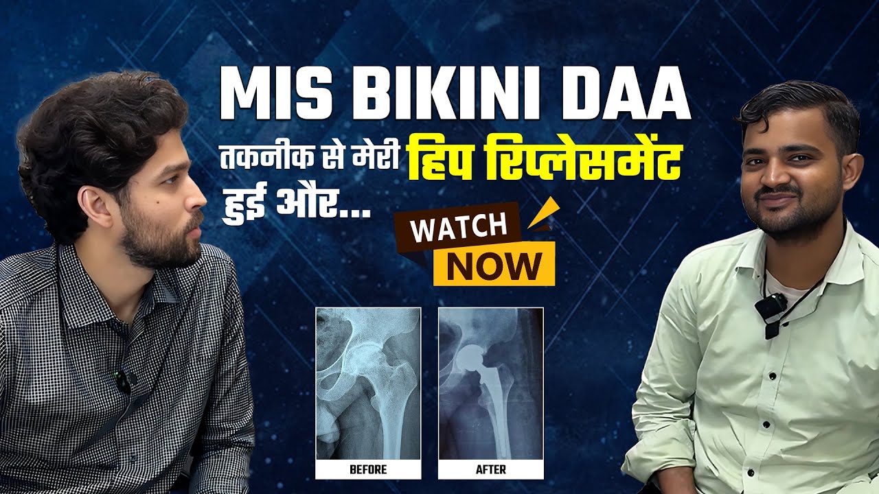 100% Relief After MIS BIKINI DAA Hip Replacement | Hip Pain Treatment In Delhi - NCR - Dr DP Sharma