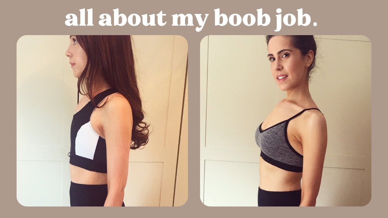 Boob Job 2 Years On | Mini Boob Job? Regrets? Advice? Q&A | Love Ciandra