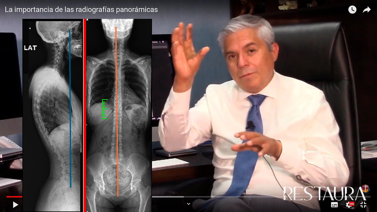 La importancia de las radiograf&iacute;as panor&aacute;micas